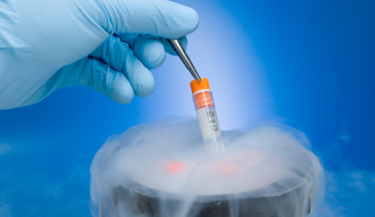 Fertility preservation services at Neev IVF through egg and sperm freezing.